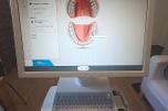 Sirona CEREC AC dental CAD/CAM skanner med intraoral kamera