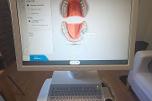 Sirona CEREC AC dental CAD/CAM skanner med intraoral kamera