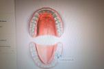 Sirona CEREC AC dental CAD/CAM skanner med intraoral kamera