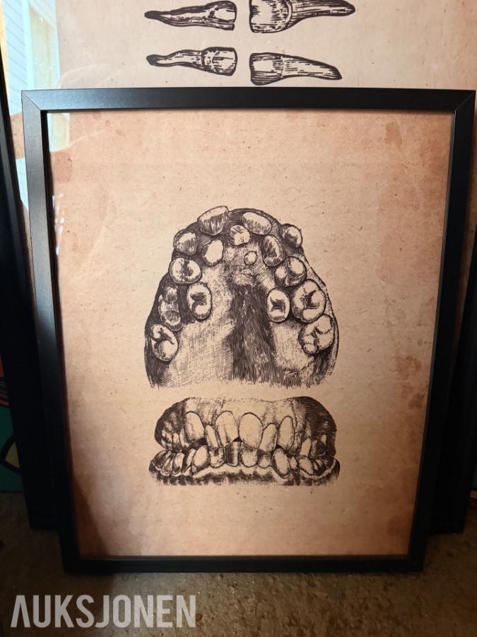 2025 Kunstsamling bilder med tannlege-/dentalmotiv selges samlet